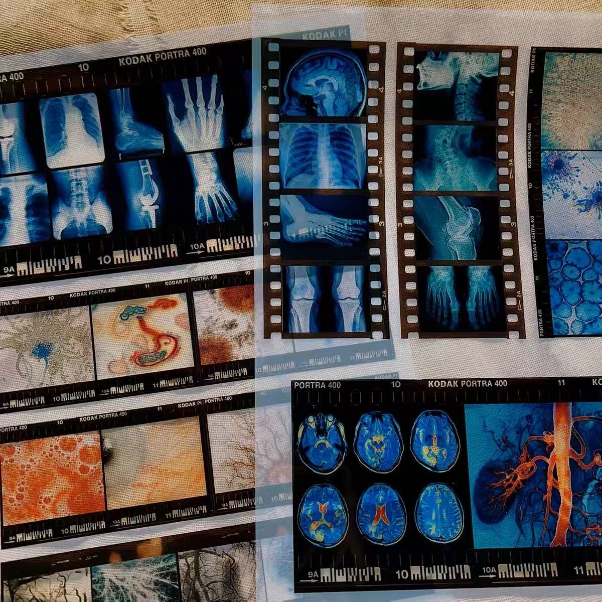 A4 Vintage Medical Film 2 pcs
