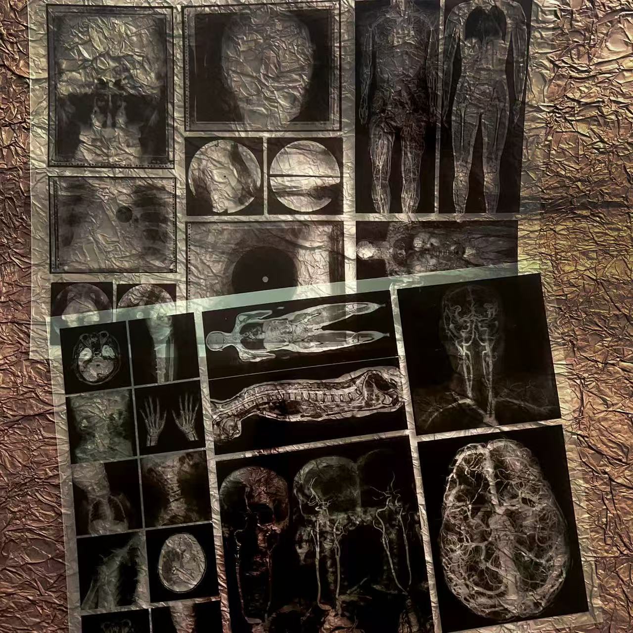 1028 A4 Dark Hospital X-ray Film 2 pcs