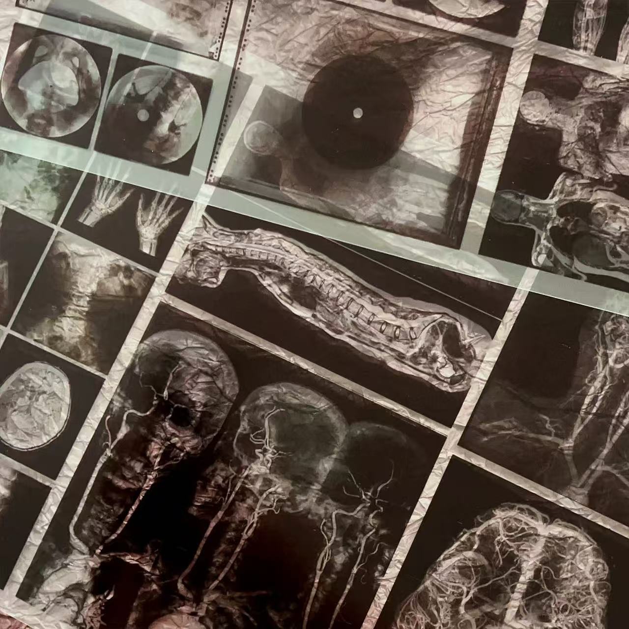 1028 A4 Dark Hospital X-ray Film 2 pcs