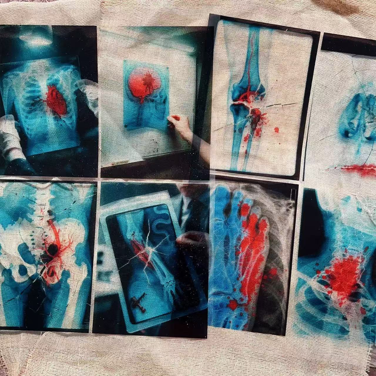 0628 A4 Dark Hospital X-ray Film 2 pcs