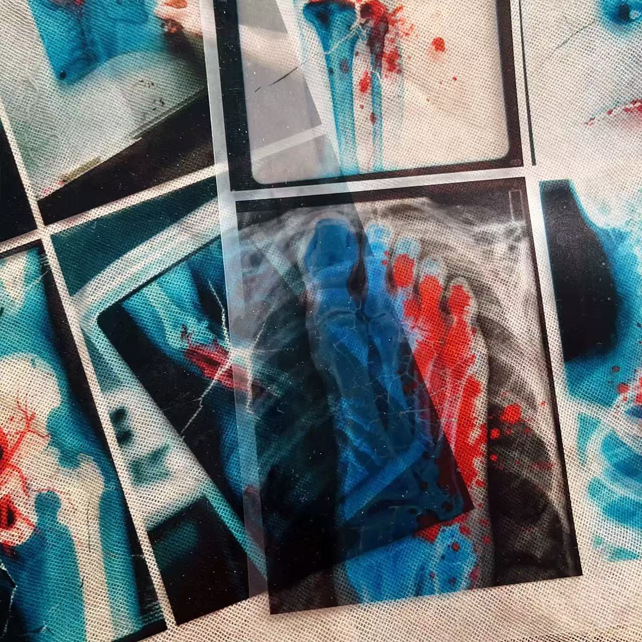 0628 A4 Dark Hospital X-ray Film 2 pcs